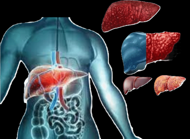 World Hepatitis Day 2025